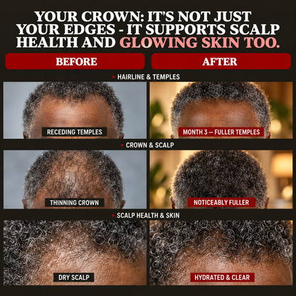 LUMIN-RRB Hair Growth Gummies